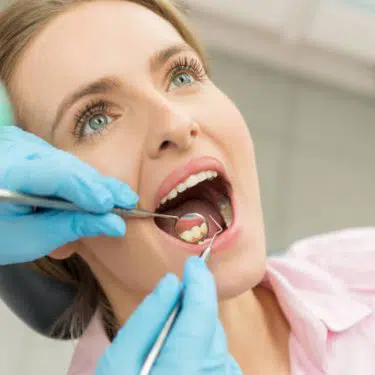 Choroby ústnej dutiny -Existuje mnoho opatrení, ktoré môžete urobiť, aby boli Vaše zuby zdravé.Udržiavanie zdravých zubov a ďasien je celoživotný záväzok.